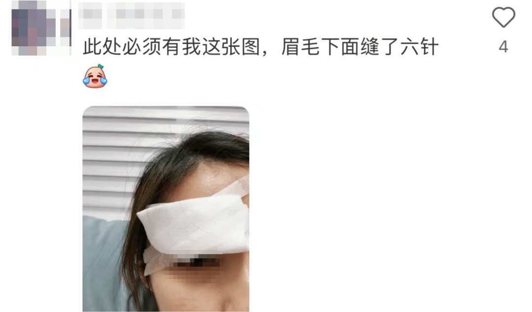 “杀伤力”惊人！击穿眉骨、扎穿手指……这项球速达300km/h的人气运动暗藏风险！